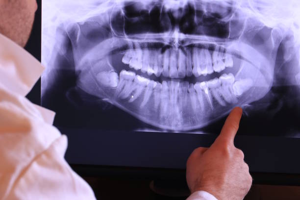 Best Emergency Treatment for Jaw Pain or Injury in Gary, IN