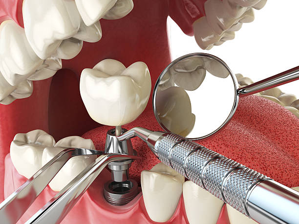 Best Emergency Denture Repair in Gary, IN